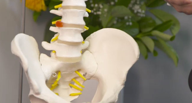 spine condition of sacroiliac joint