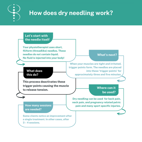 Infographic on how dry needling works